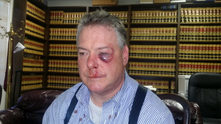 James Crawford Beating Photo